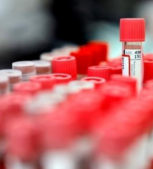 Vital Brazil e UFRJ testam soro para tratar covid-19.