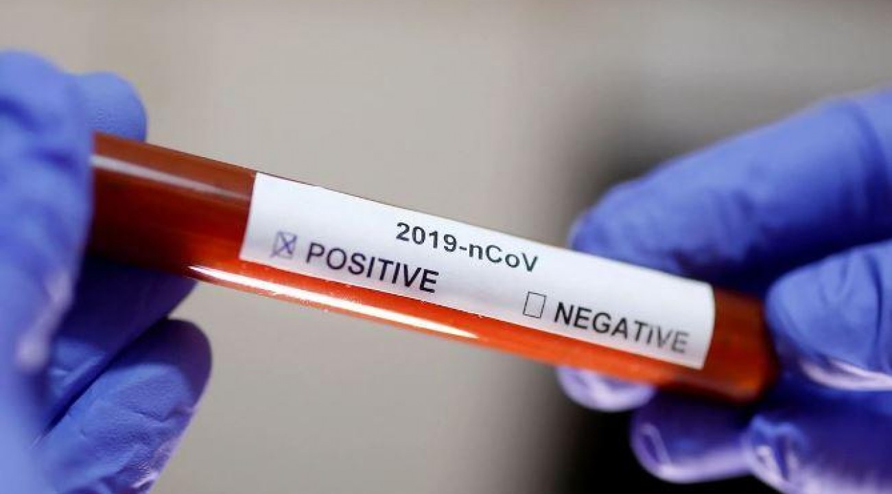 Paial (SC): Bebê de apenas 3 meses testa positivo para coronavírus.