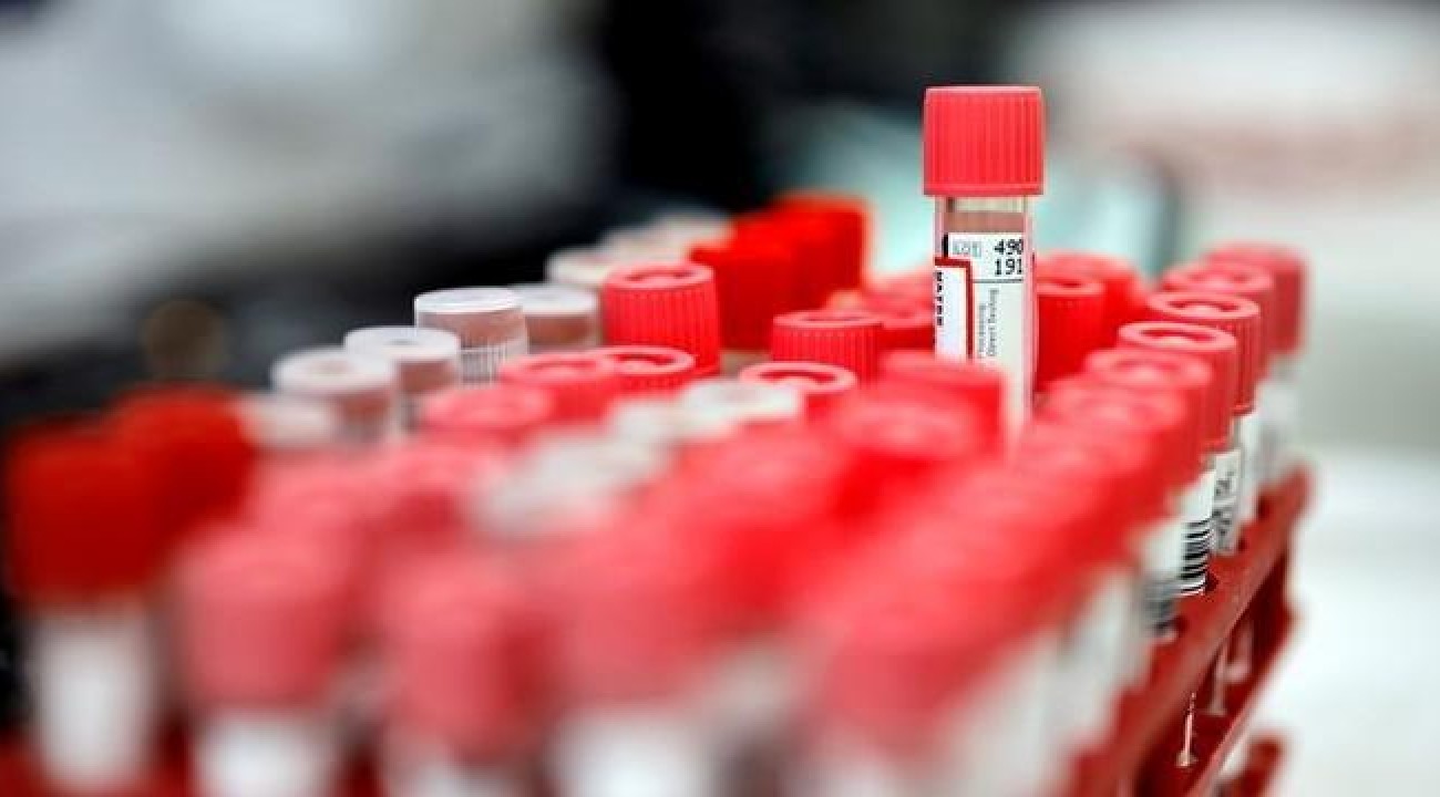 Vital Brazil e UFRJ testam soro para tratar covid-19.