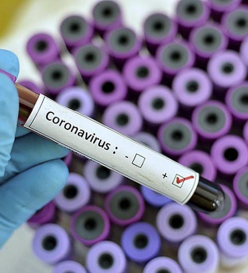Chapecó (SC) confirma 2ª morte por coronavírus em menos de 24h.
