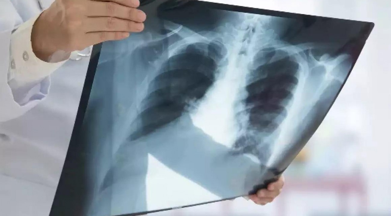 Reforço de inverno: governo gaúcho anuncia mais R$ 112 milhões para hospitais e prefeituras